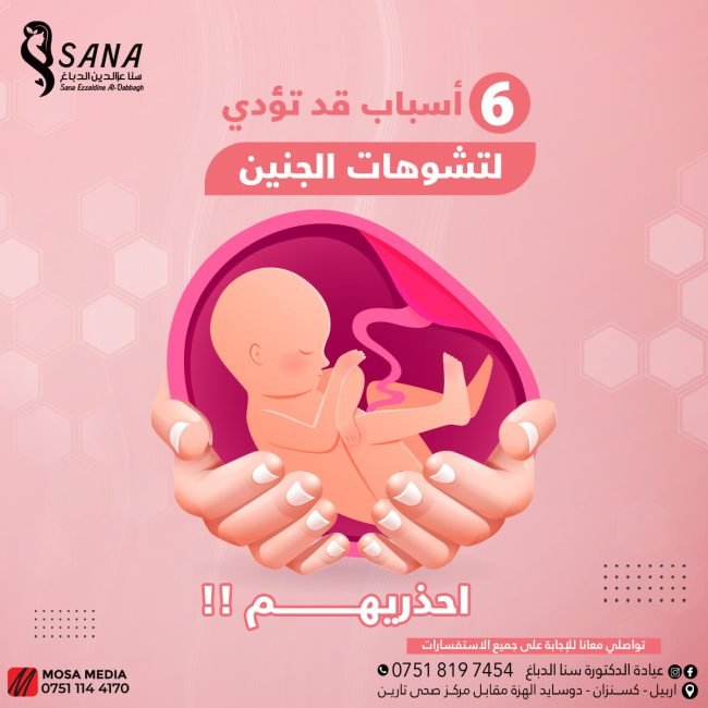 تشوهات الجنين