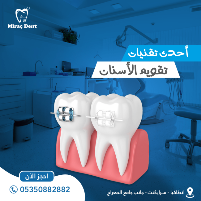 تقويم الاسنان