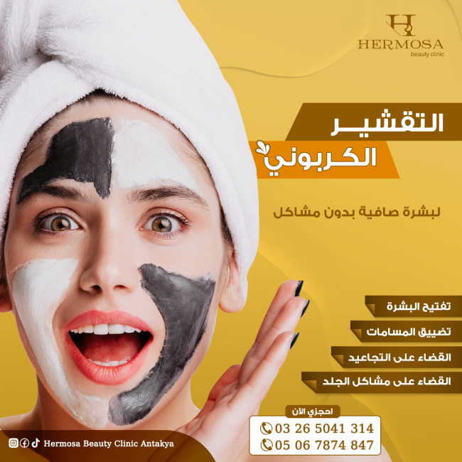 خدمة تقشير البشر بالكربون